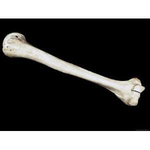  Humerus Bone of Upper Arm Skeletal System Tissue 