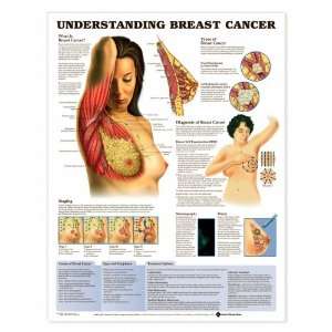   Breast Cancer Anatomical Chart Plastic Styrene: Health & Personal Care